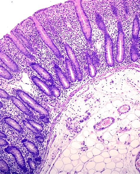 Large Intestine Mucosa Light Micrograph Stock Image C0475667