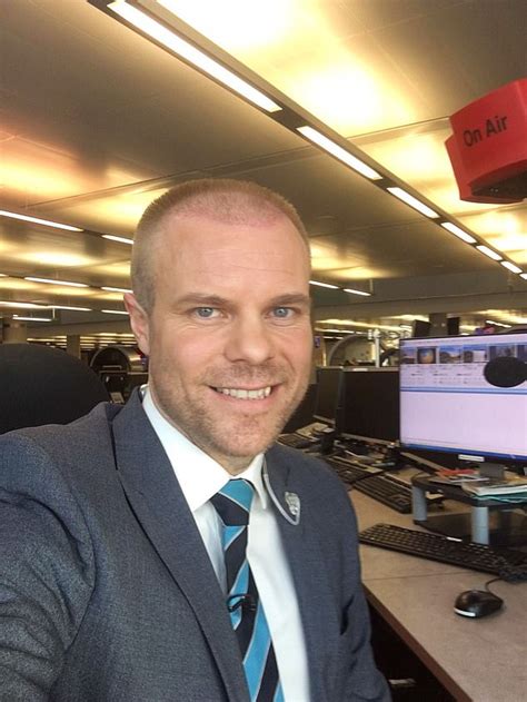 Bbc Weather Presenter Simon King Unveils His New Hair Transplant