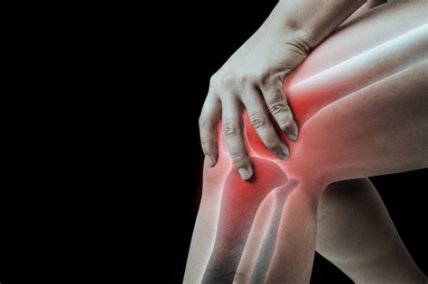 Ból kolana Przyczyny i leczenie Dlaczego nie wolno go lekceważyć Porady w INTERIA PL
