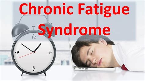 Chronic Fatigue Syndrome - YouTube