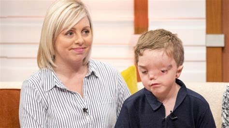 Mums Fury After Instagram Picture Of Her Sons Face Is Removed Good