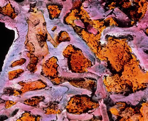 Coloured Sem Of Bone Marrow In Spongy Bone Photograph By Prof P Motta