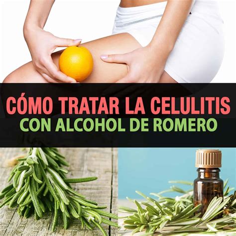 C Mo Tratar La Celulitis Con Alcohol De Romero La Gu A De Las Vitaminas