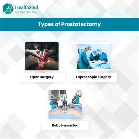 Prostatectomy Indications And Risks Healthsoul