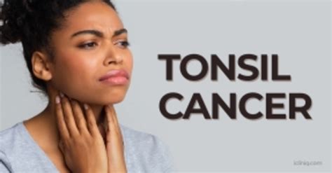 Health Articles In Tonsil Cancer