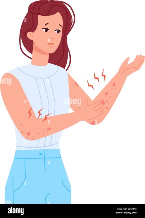 Woman Scratching Skin Girl With Itching Elbow Hand Or Rash On Body