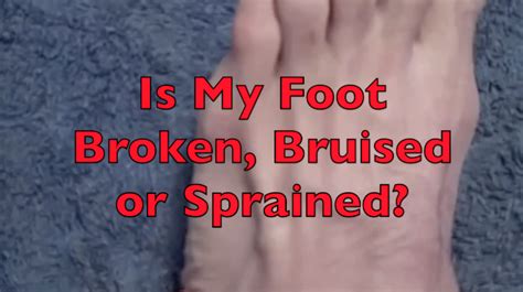 How To Tell If Your Toe Is Broken Or Sprained The Request Could Not Be