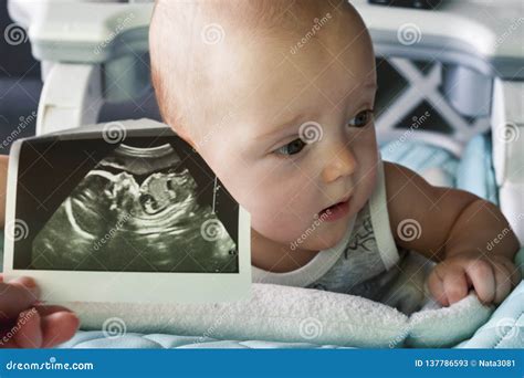 Ultrasound Image At The 20th Week Of Pregnancy In The Background Is A