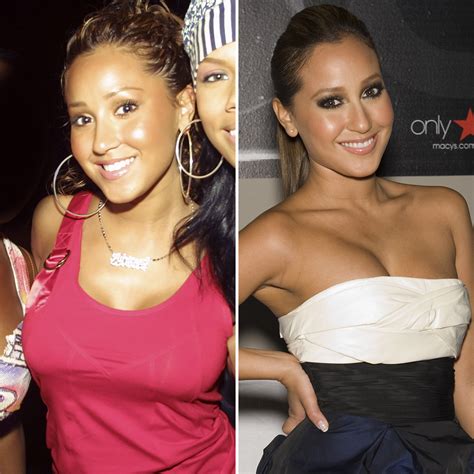 celebrities who removed their breast implants— before and after pics
