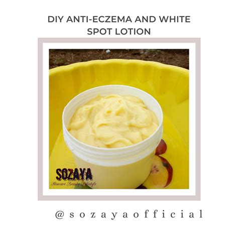 How To Get Rid Of White Spots On The Body Sozaya