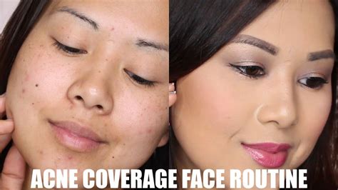 Acne Dark Spot Coverage Routine Full Face Concealer Foundation
