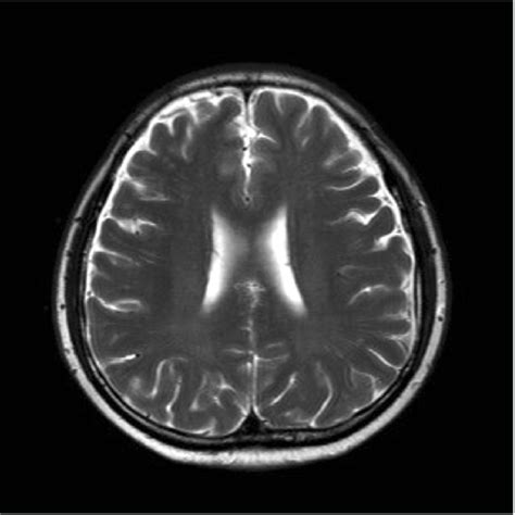 Brain Magnetic Resonance Imaging Download Scientific Diagram