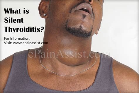 What Is Silent Thyroiditis And How Is It Treated