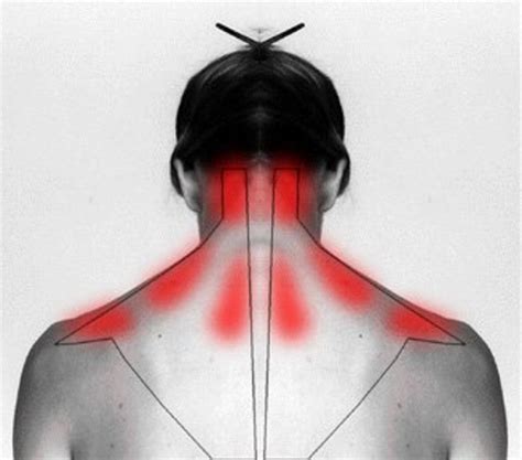 How To Treat And Cure Your Stiff Neck Or Shoulder To Ease The Pain In