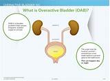 Pictures of Overactive Bladder Doctor