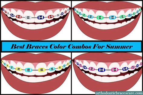 31 Unique Braces Colors And Combinations For Summer Orthodontic