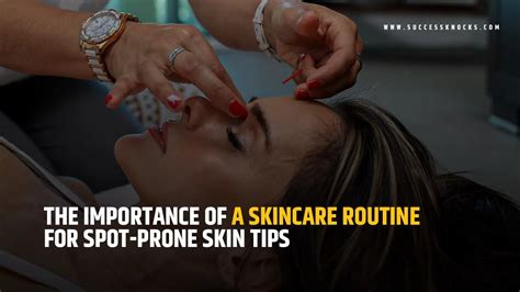 The Importance Of A Skincare Routine For Spot Prone Skin Tips For