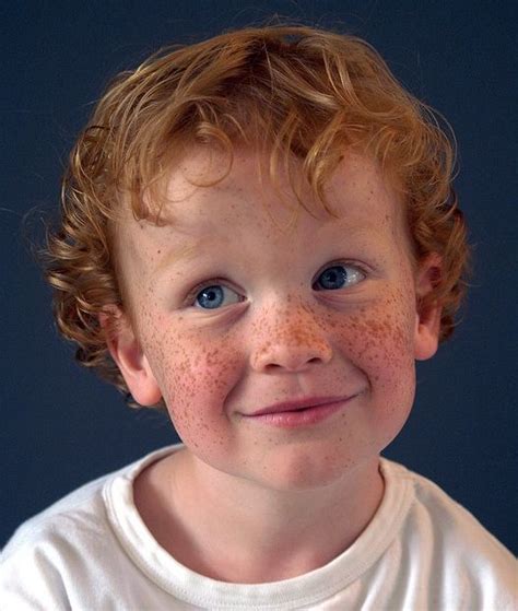 Freckles Fascination Red Hair Freckles Freckles Red Hair