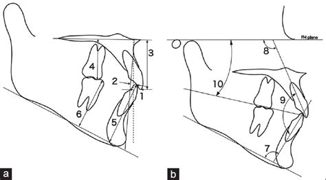 A Dental Hard Tissue Cephalometric Reference Landmarks And Variables Download Scientific