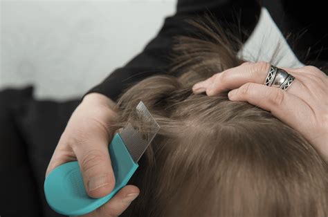 What Do You Need To Know About Getting Proper Head Lice Removal
