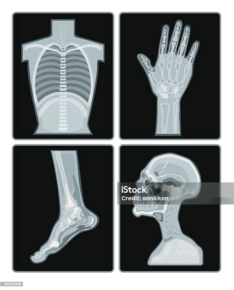 Xray Films Collection Stock Illustration Download Image Now X Ray