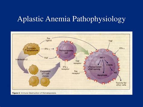 Pathophysiology Of Aplastic Anemia