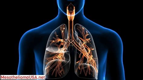 Can Radiotherapy Cure Lung Cancer