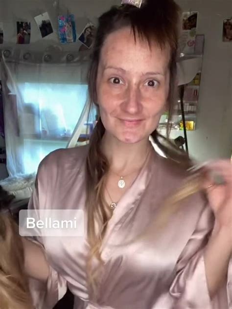 Toothless Mum Shows Off Incredible False Teeth Transformation Photos Au — Australia