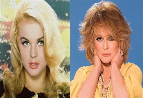 Ann Margret Plastic Surgery Before After Celebrity Plastic Surgery