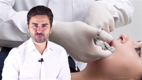 Como Se Tornar Um Expert Em Anestesia Local Odontológica Youtube