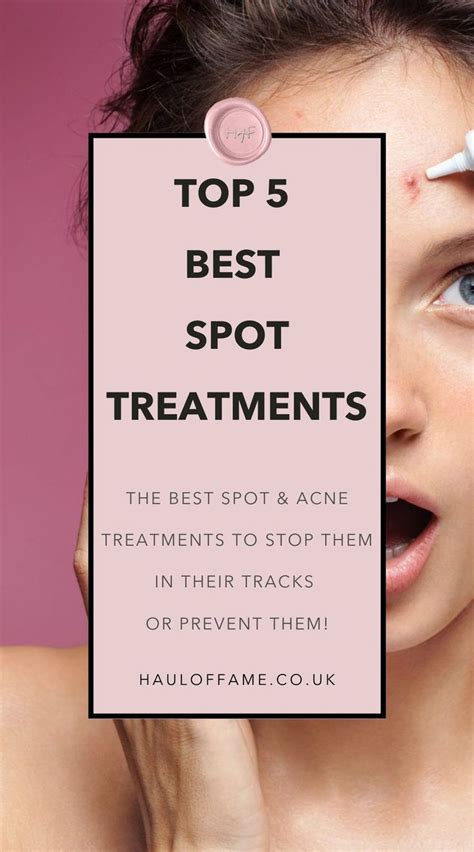 Top 5 Best Spot Treatments For Emergencies Haul Of Fame In 2021