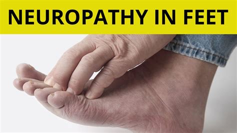 Peripheral Neuropathy Treatment Tips On How To Handle Neuropathy In Feet YouTube