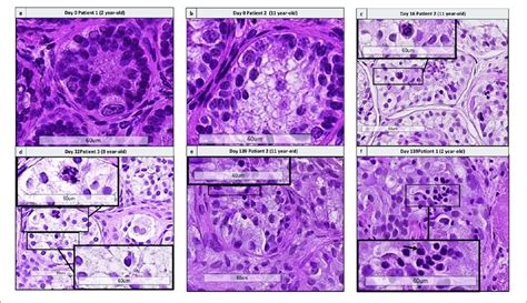 Histological Assessment Of Differentiating Germ Cells A B Shows