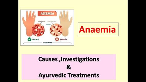 Anaemia Ayurveda L Causes L Investigations Layurvdic Treatment L Anemia Youtube