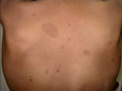 Kaffee mit milch café au lait. Photograph of the back of the trunk showing multiple | Open-i
