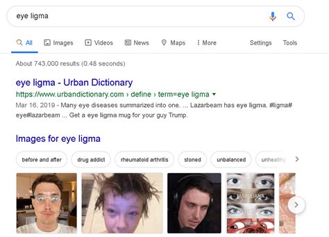 The First Picture That Comes Up When I Search Eye Ligma Rlazarbeam