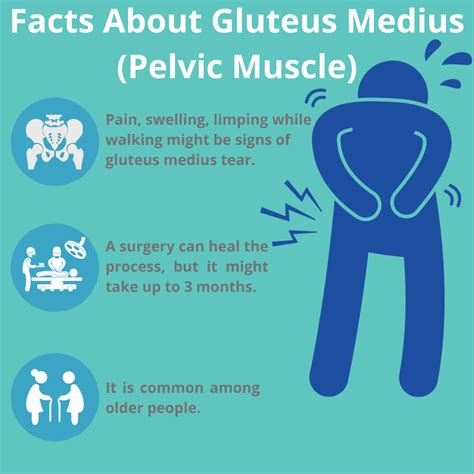 Gluteus Medius Pain