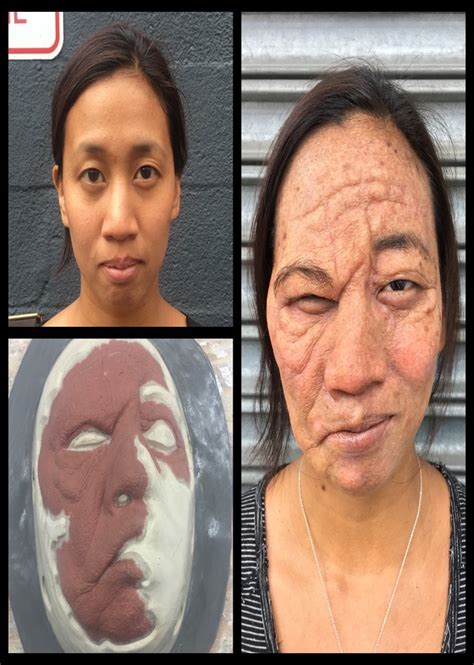 Before And After Stroke Victim And Aging