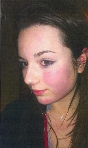 Selfie Of Aberdeen Student Emily Drouets Battered Face Daily Mail Online