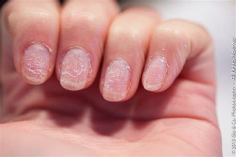 Butter london claims their new formula has ingredients that promote healthier, stronger, and brighter. Does gel nail polish damage your nails - New Expression Nails