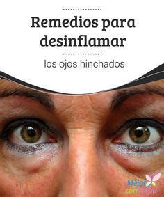 Como Deshinchar Los Ojos En Minutos Consejos Ojos