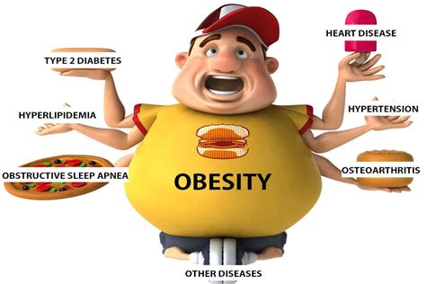 How it differs from being overweight. Obesity :Health Challenge of the 21st Century - Asia ...