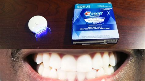 Teeth Whitening Kit With Light Instructions Teeth Poster
