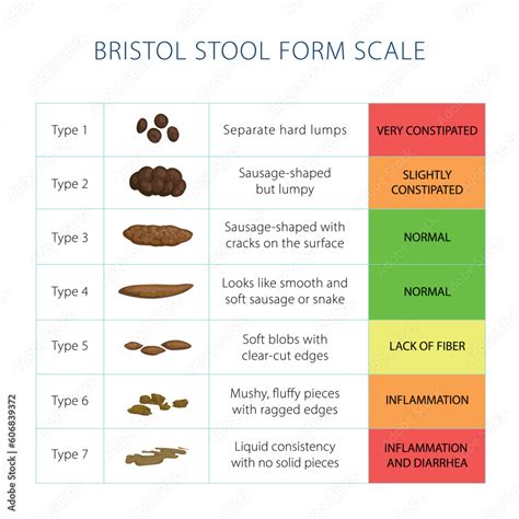 Bristol Stool Scale Table Medical Diagnostic Infographics Different