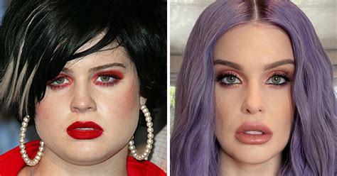 Kelly Osbourne Insists She Hasnt Had Any Cosmetic Surgery And Heres How She Explains It