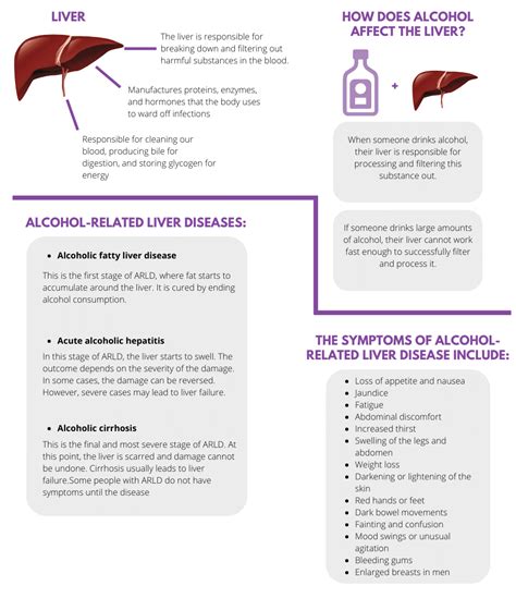 Alcohol Related Liver Disease Signs Symptoms And Treatment
