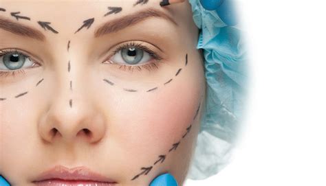 Roysothers Cirugía Facial