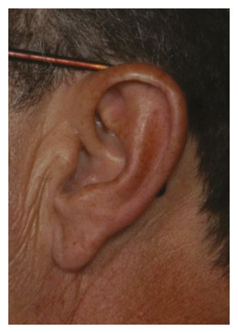 Examples Of Original Ear Images A Example Of A 2d Profile Image For