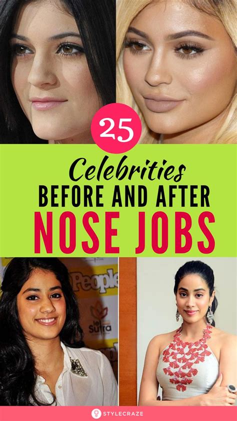 Top 25 Celebrities Before And After Plastic Surgery And