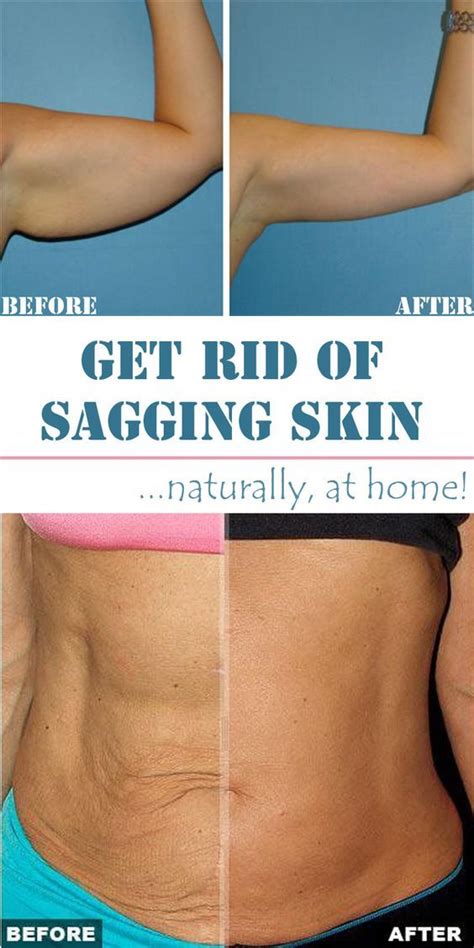 9 Secret Home Remedies For Sagging Skin That Works Healthy Cure Blog